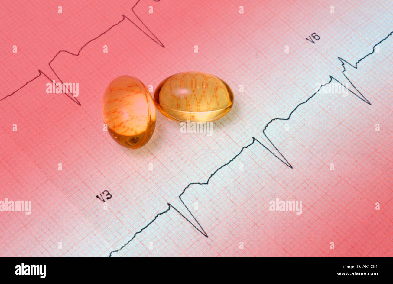 Zwei Gele auf EKG-Anzeige eines Patienten bei Herzinsuffizienz Stockfoto