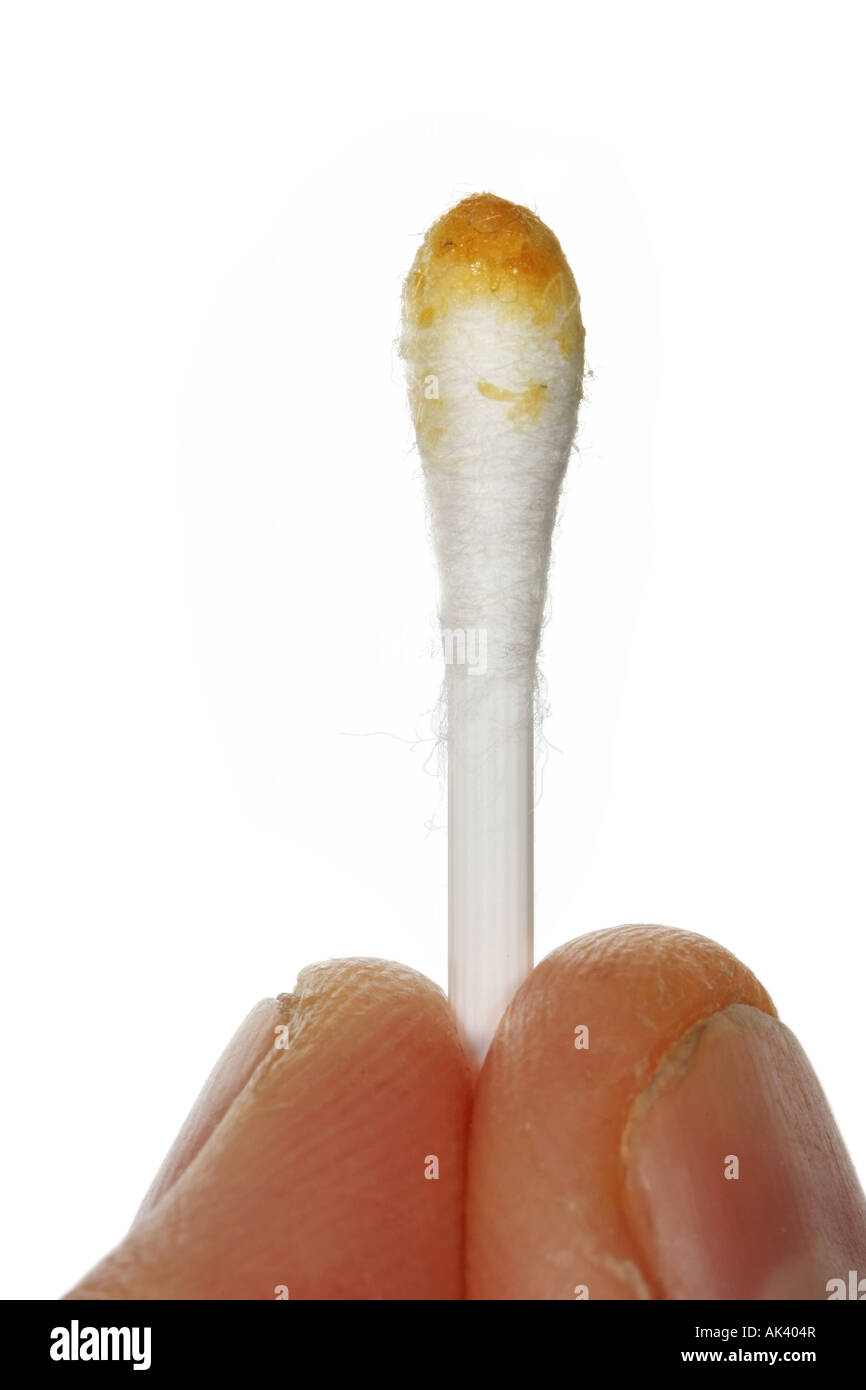 Nahaufnahme von zwei Fingern, die mit einem q-Tip voller Ohrenschmalz Stockfoto