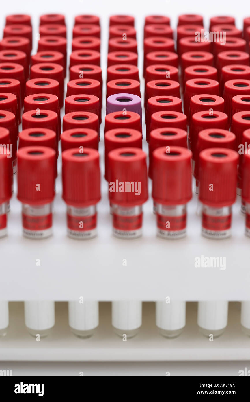 Reagenzgläser mit rotem Deckel rund um eins mit lila Deckel Stockfoto