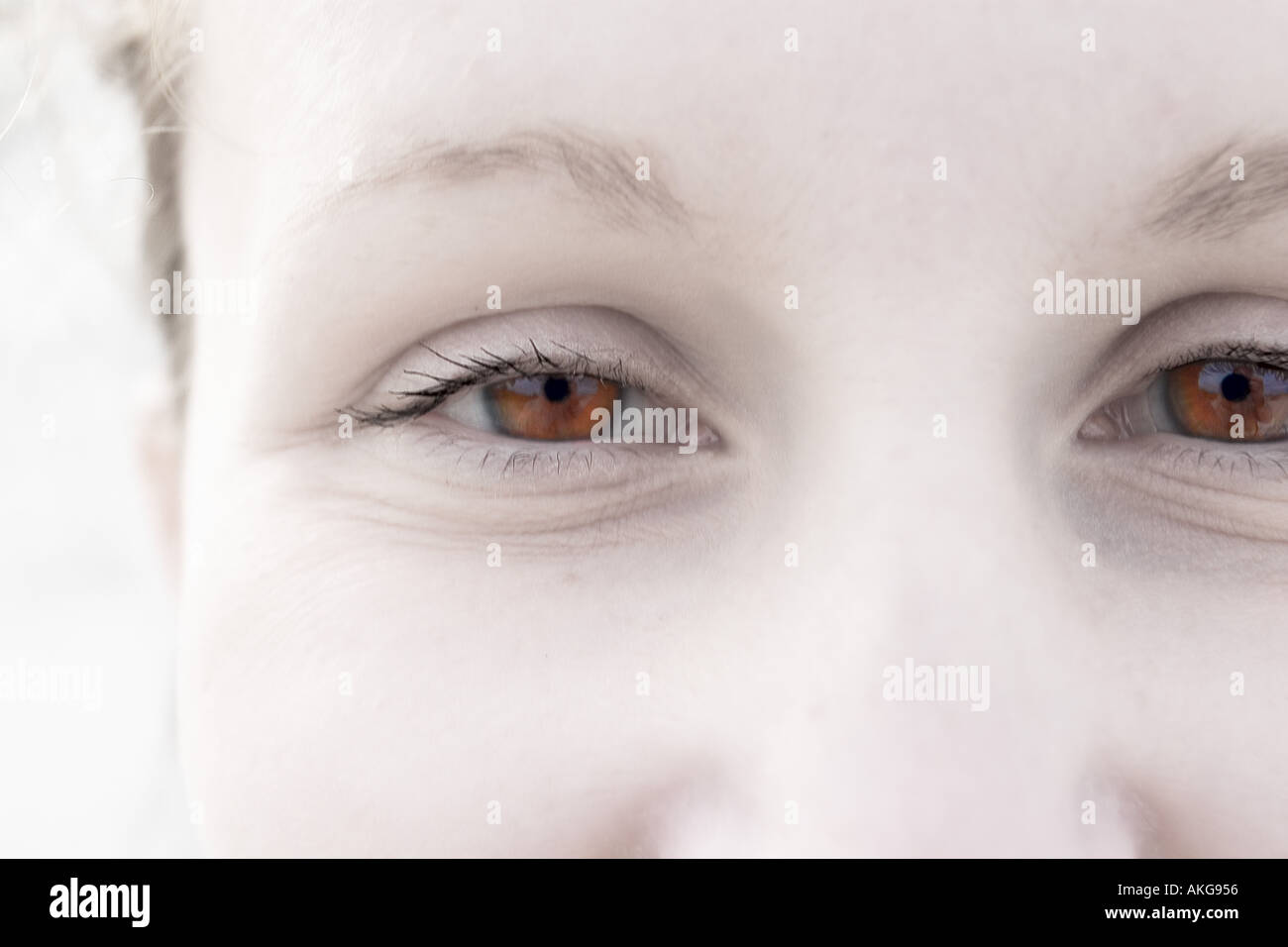 Augen des Lächelns Albino-Frau Stockfoto