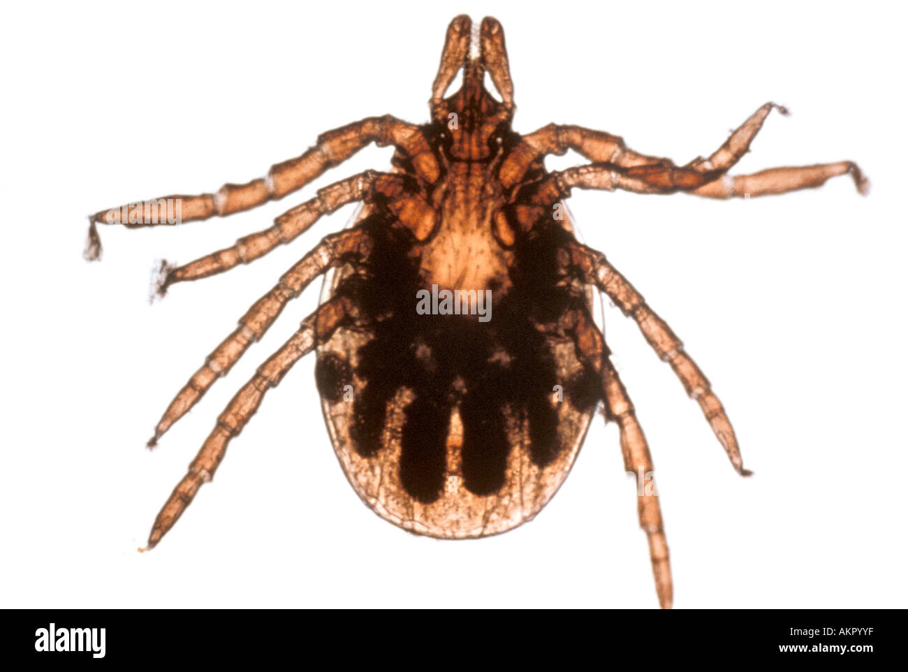 Zecken Ixodes Nymphe Stockfoto