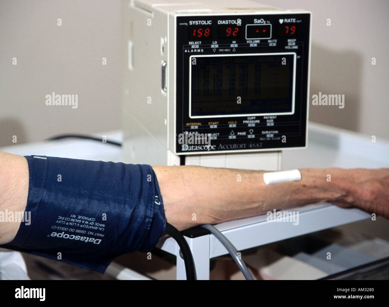 Blutdruck und Cholesterinspiegel, die Überprüfung der Herz-Kreislauferkrankungen. Stockfoto