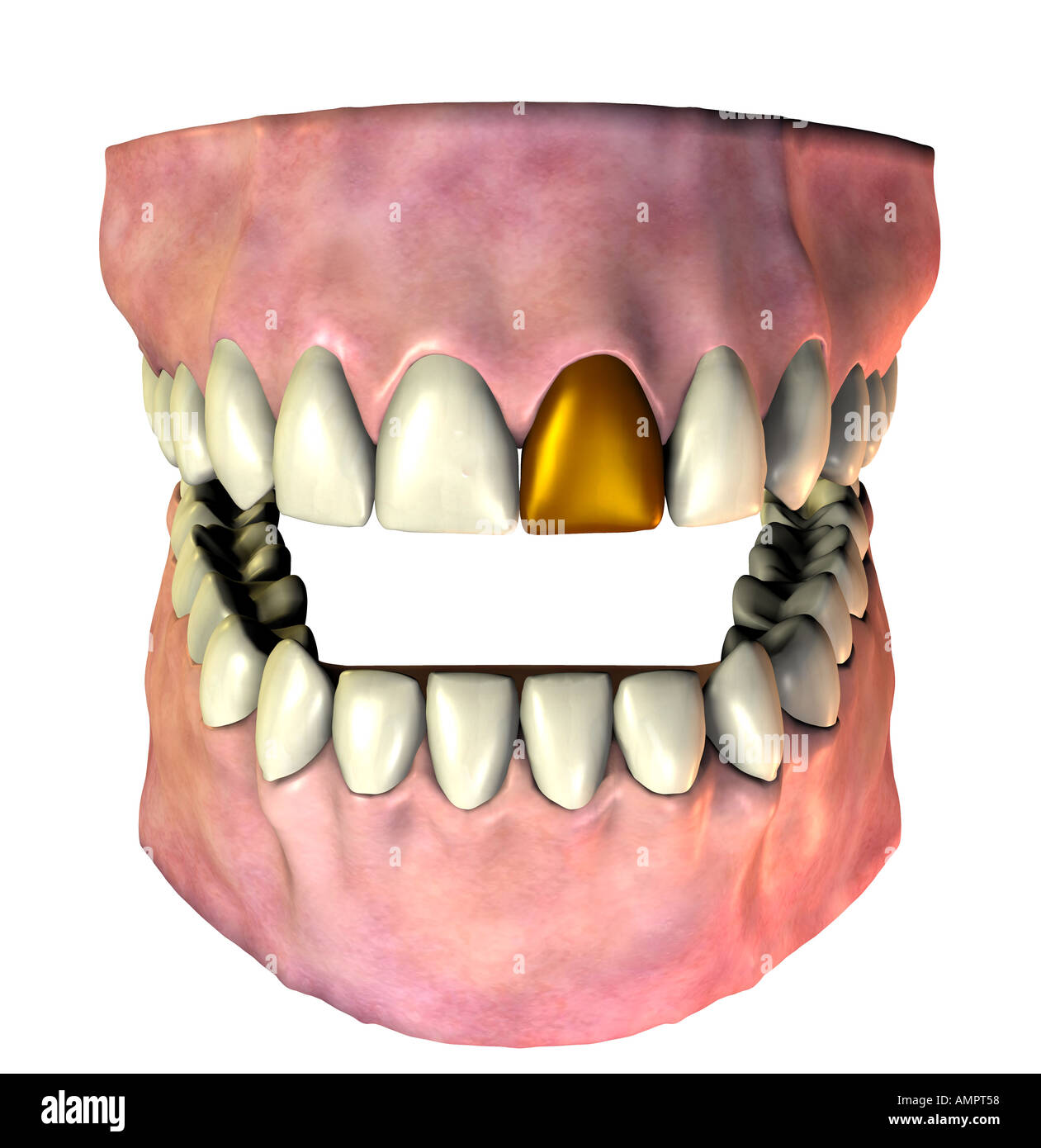 Pivot tooth -Fotos und -Bildmaterial in hoher Auflösung – Alamy