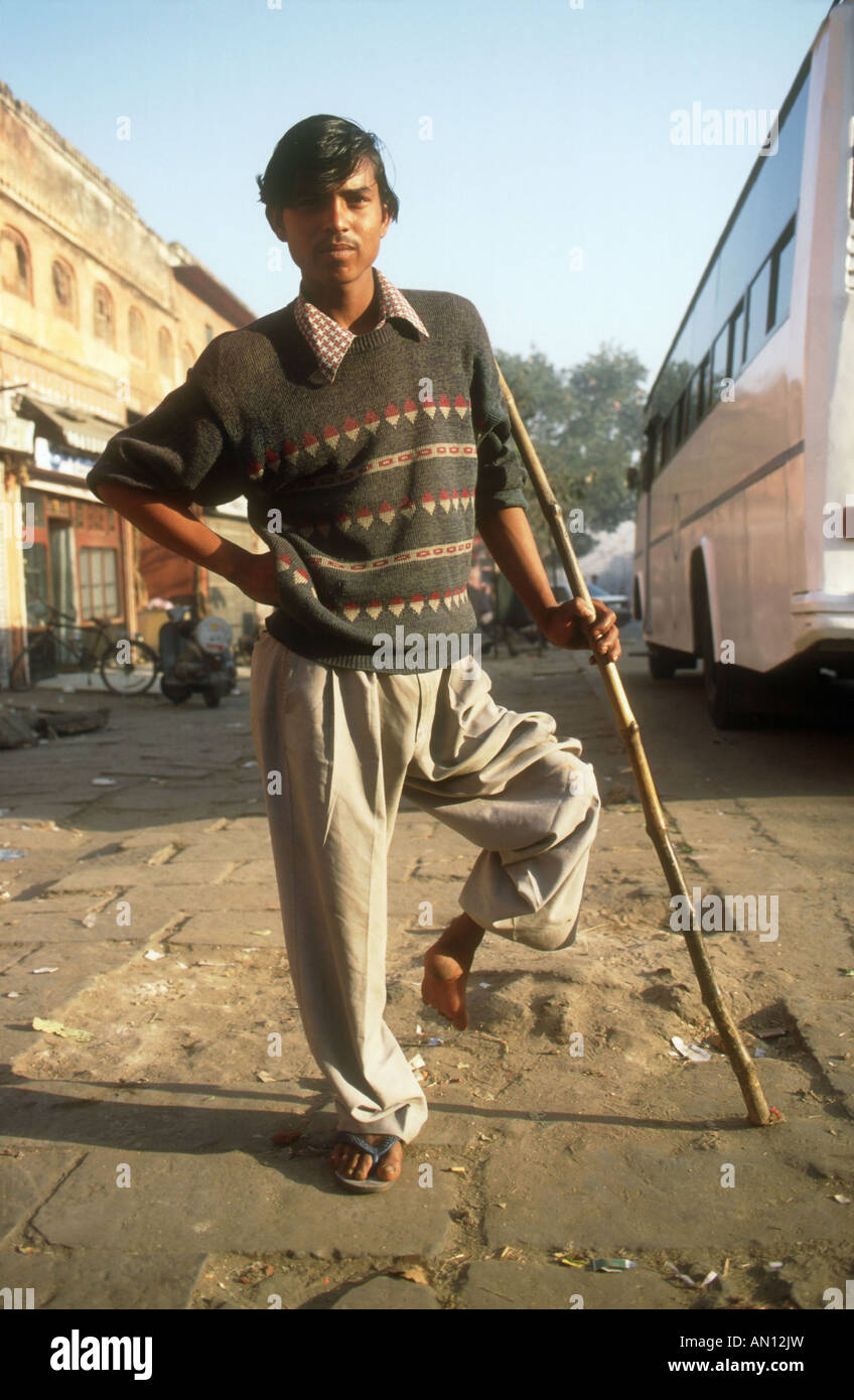 Mann mit deformierten Bein mit einem Stock um sich abzustützen. Indien Stockfoto