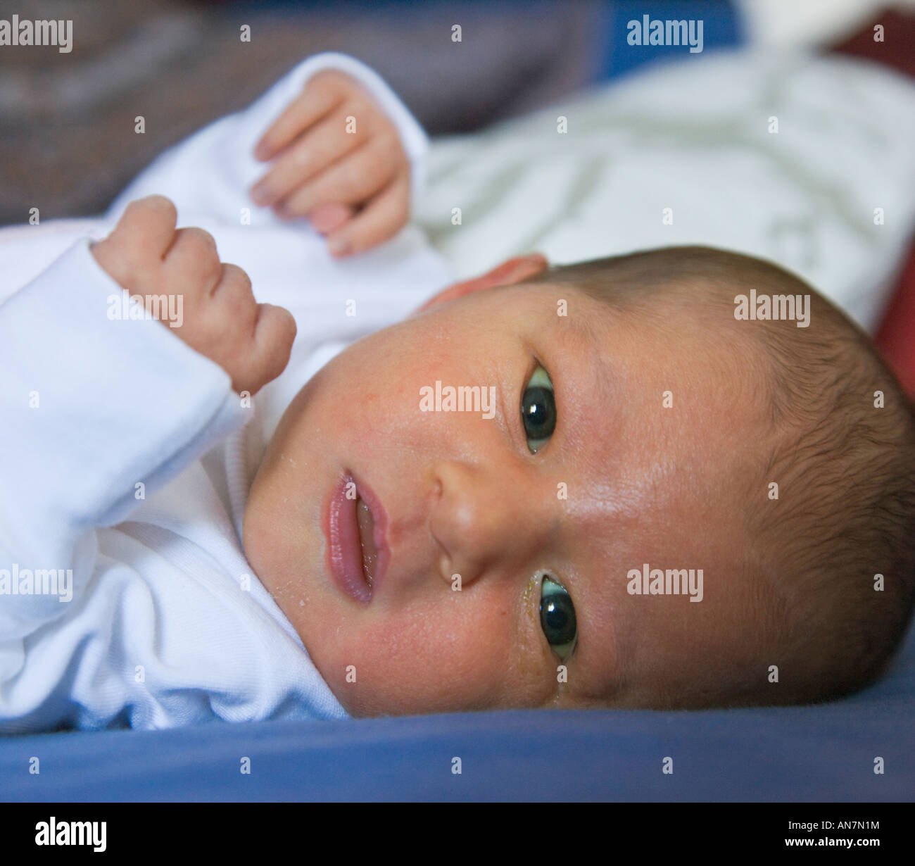 Baby mit Gelbsucht Stockfotografie - Alamy