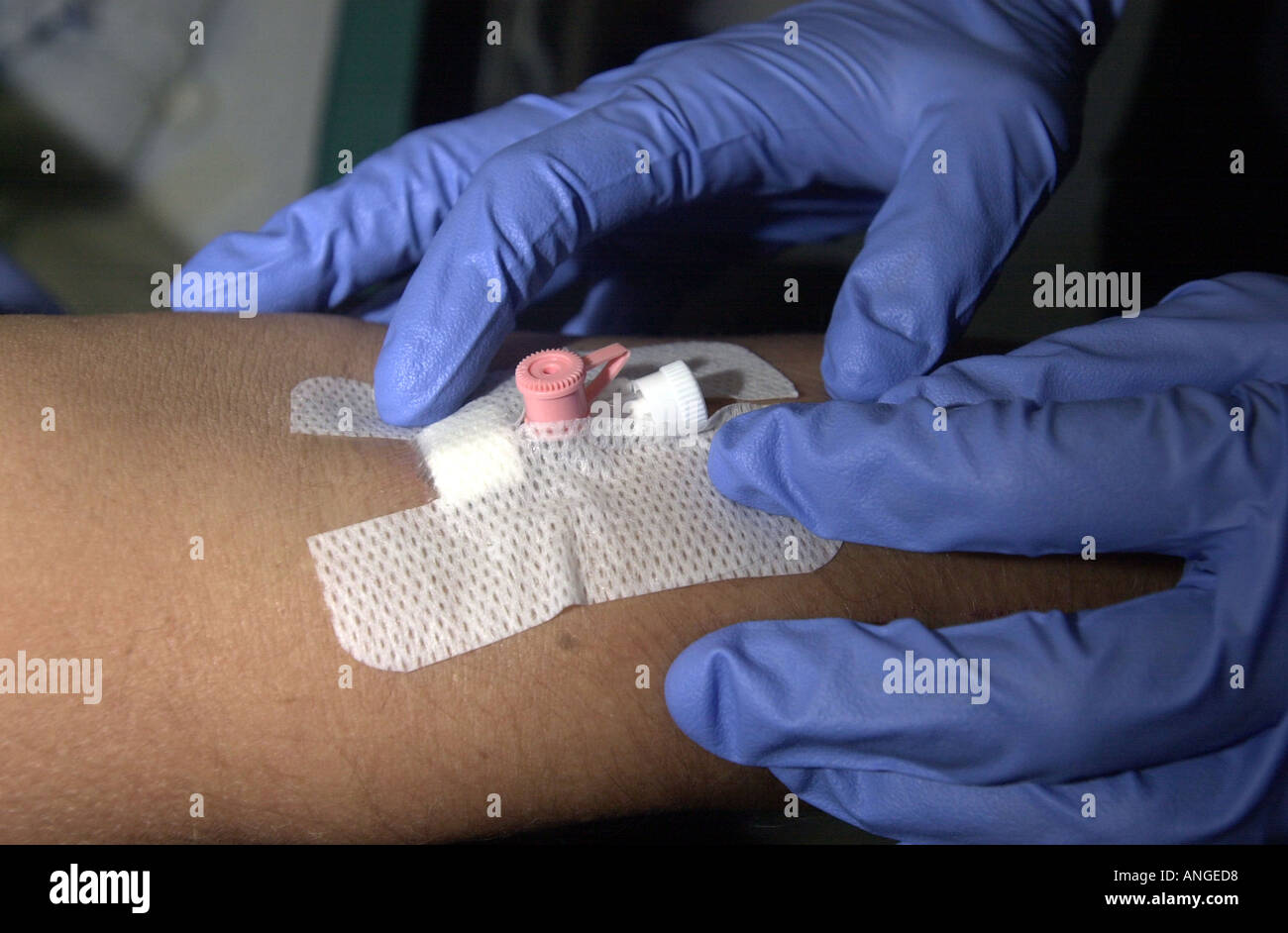 Krankenschwester bereitet die Infusion an einem Arm des Patienten UK Stockfoto