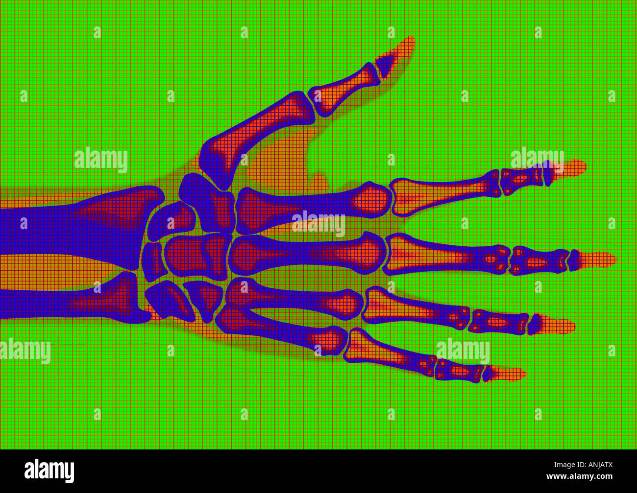 Röntgen-Darstellung der menschlichen Hand auf medizinischer monitor Stockfoto