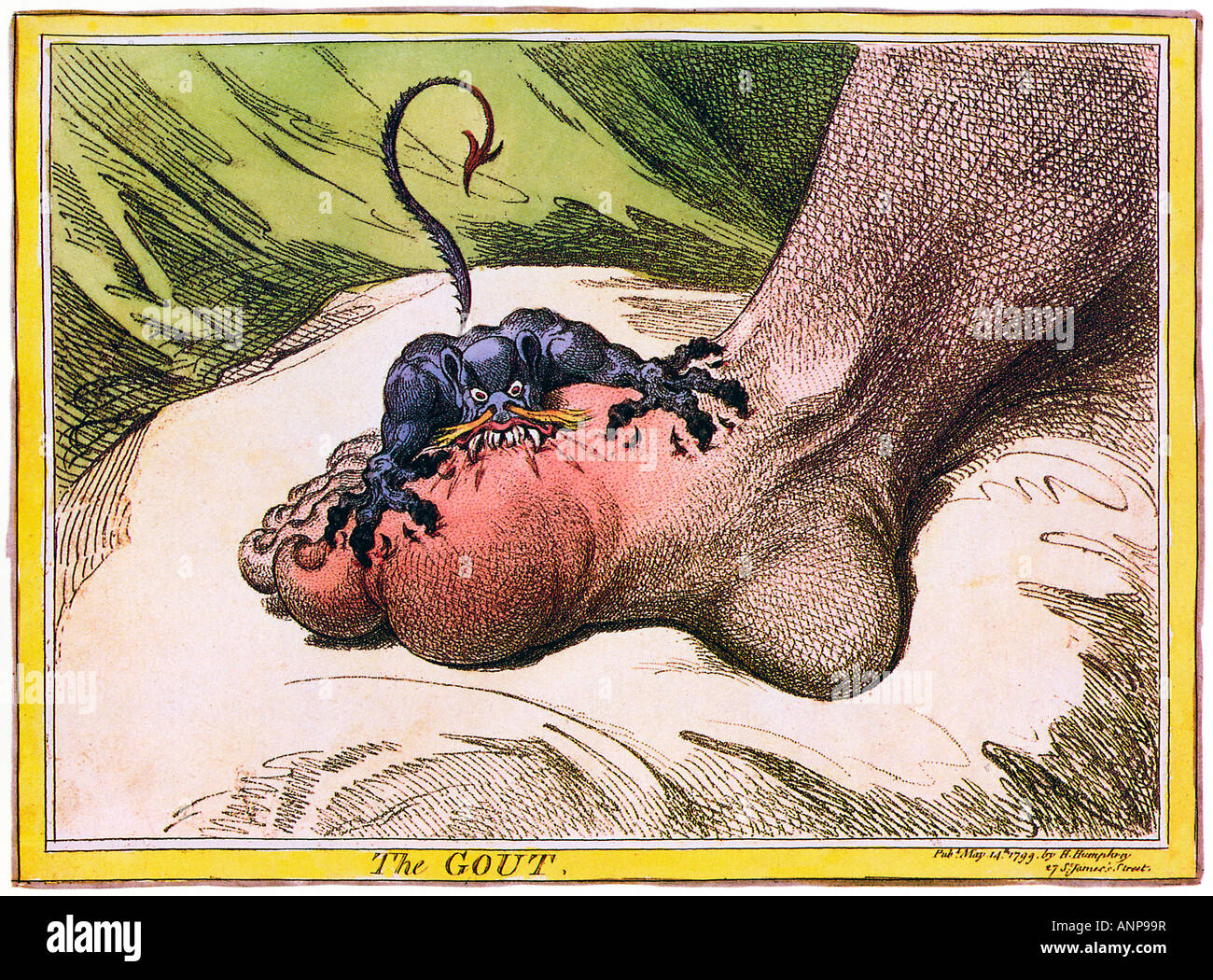 Die Gicht James Gillray 1799-Cartoon von den großen Karikaturisten der Agonie induziert durch die entzündliche Erkrankung Stockfoto
