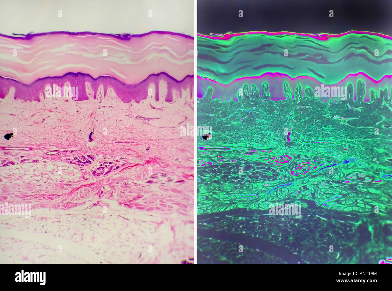 Mit Schweißdrüsen der Haut Stockfoto