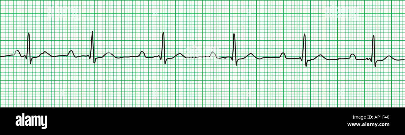 ECG Elektrokardiogramm Stockfoto