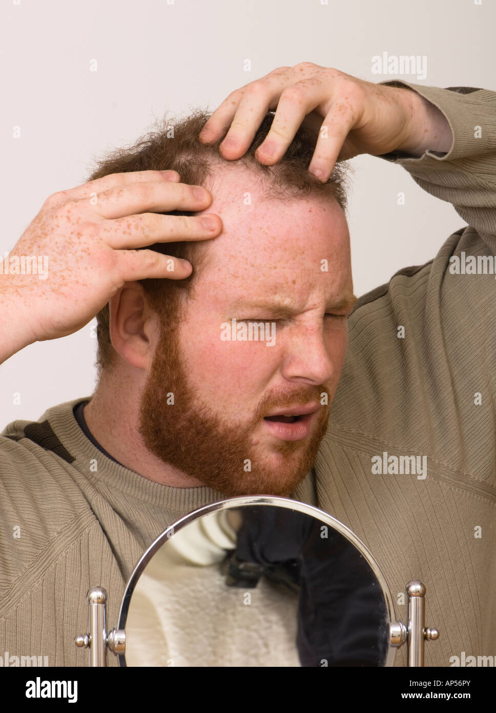 besorgt Man sich entfernenden Haaransatz untersuchen Stockfoto