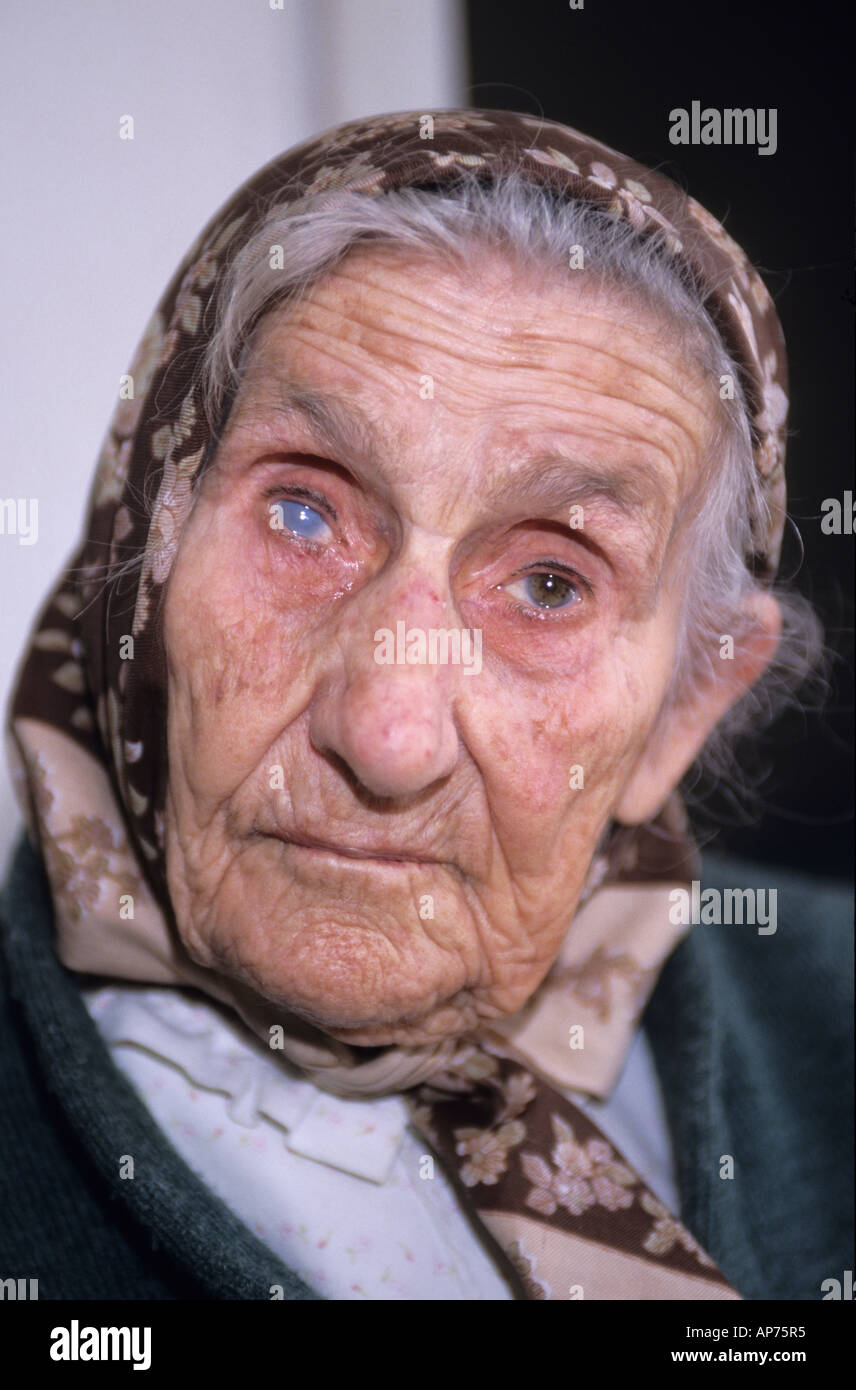 Porträt von Sehbehinderten alte Frau Stockfoto