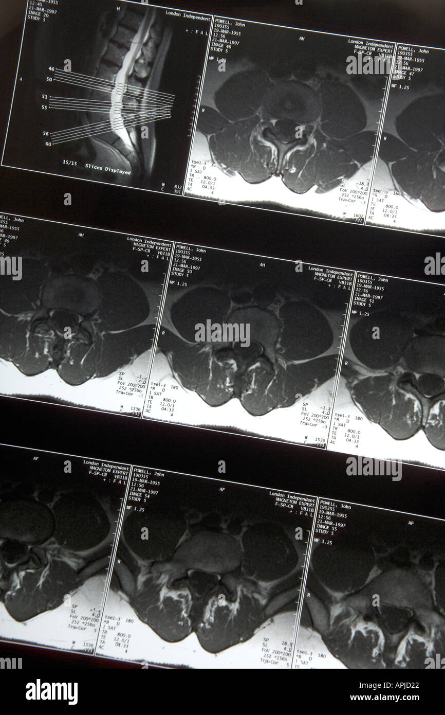 3436 X Strahlen 7 MRI Scans Modell veröffentlicht Stockfoto