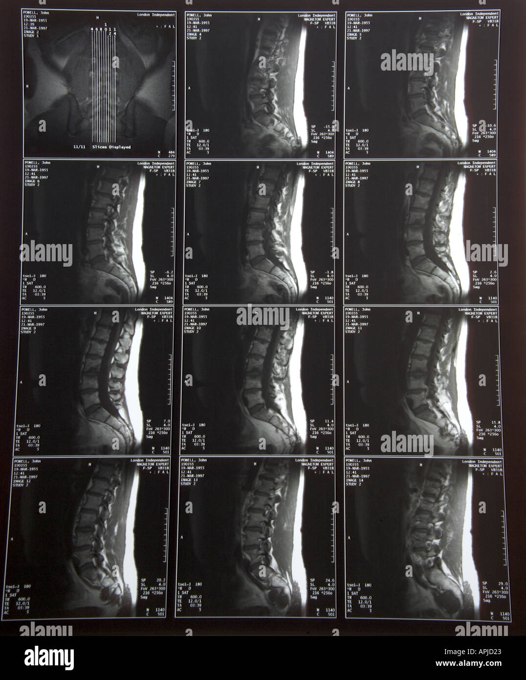 3436 X Strahlen 7 MRI Scans Modell veröffentlicht Stockfoto