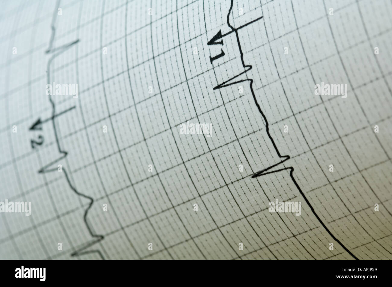 EKG Elektrokardiogramm Closeup View-Konzept Stockfoto