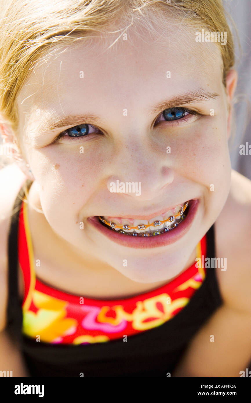 Junges Mädchen zeigt ihre Zahnspange Stockfoto