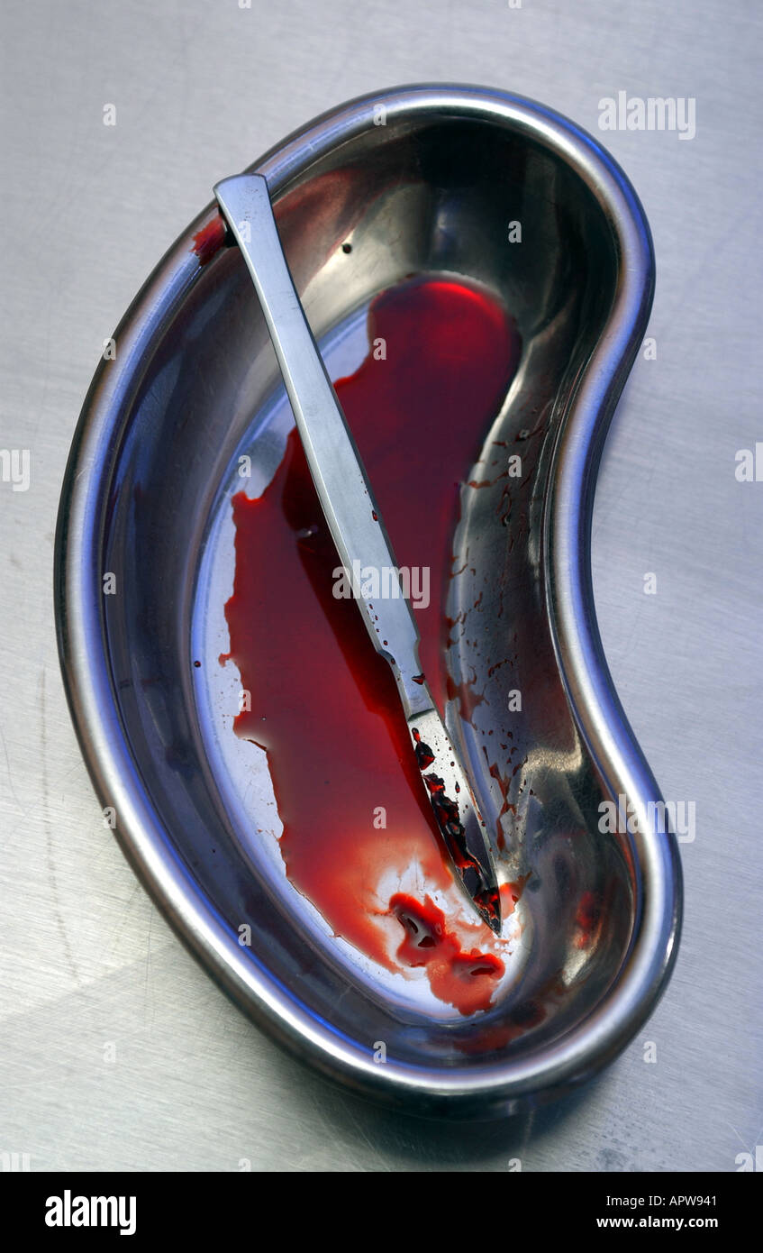 chirurgische Instrumente Skalpell verwendet mit Blut daran in einer Niere Schüssel Stockfoto