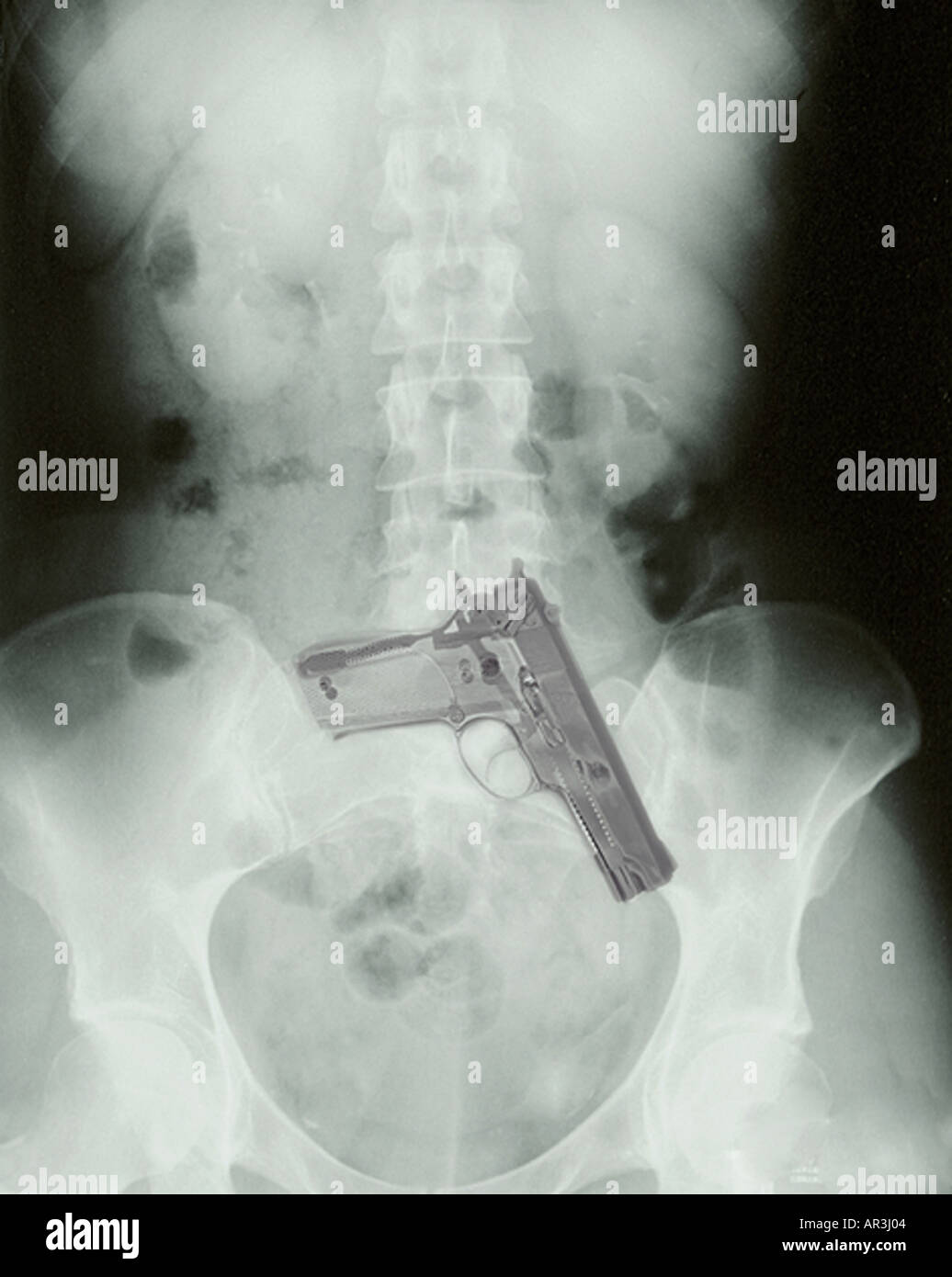 Fotomontage Bauch Xray mit Smith und Wesson 9mm Pistole Stockfoto