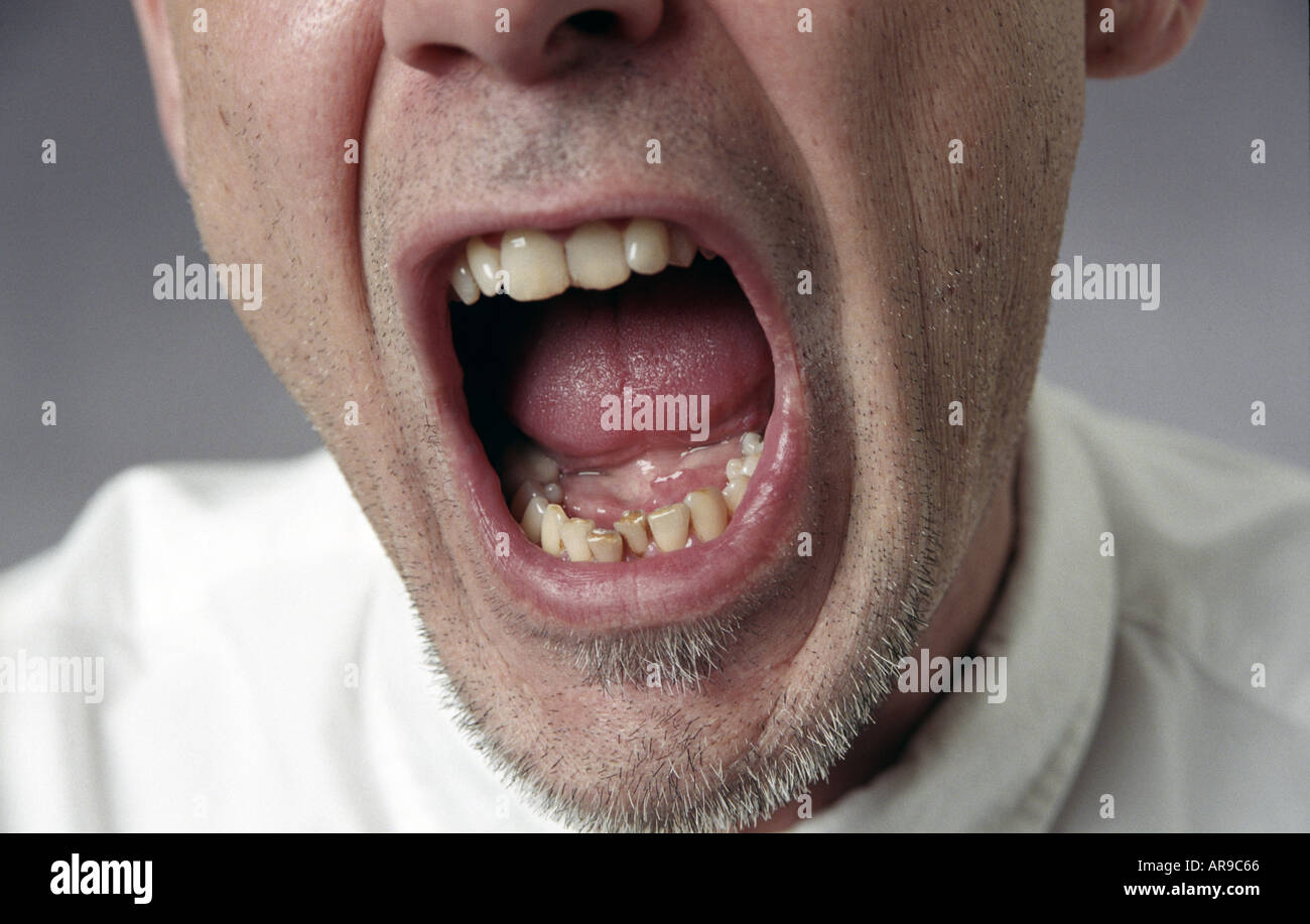 Schreienden Mann offenem Mund schreien Stockfoto