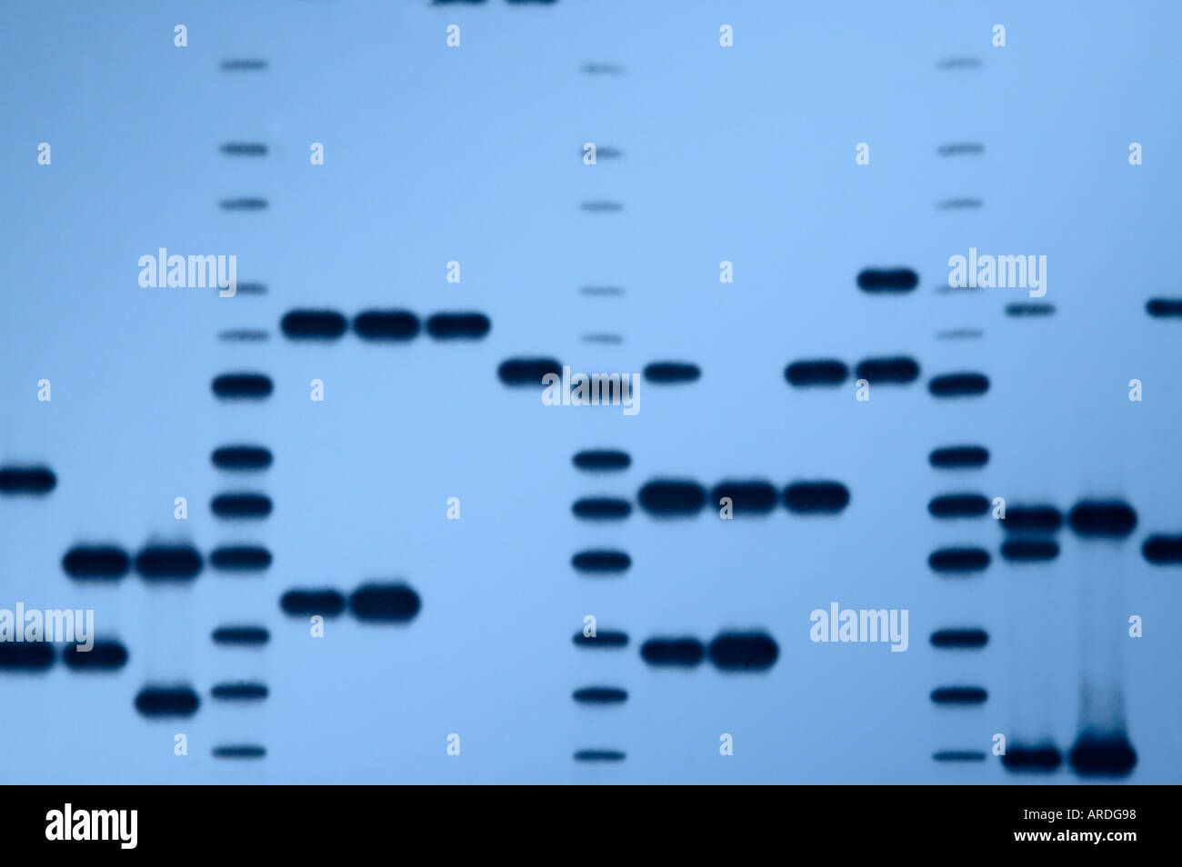 Autoradiograph "DNA-Fingerprints" einer Vielzahl von DNA-Proben. Stockfoto