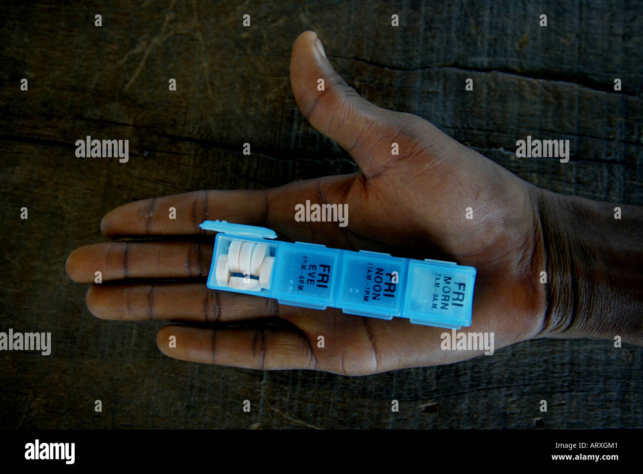 Nigeria, Westafrika hat eine Highnumber von HIV Aids infizierte Bewohner Stockfoto