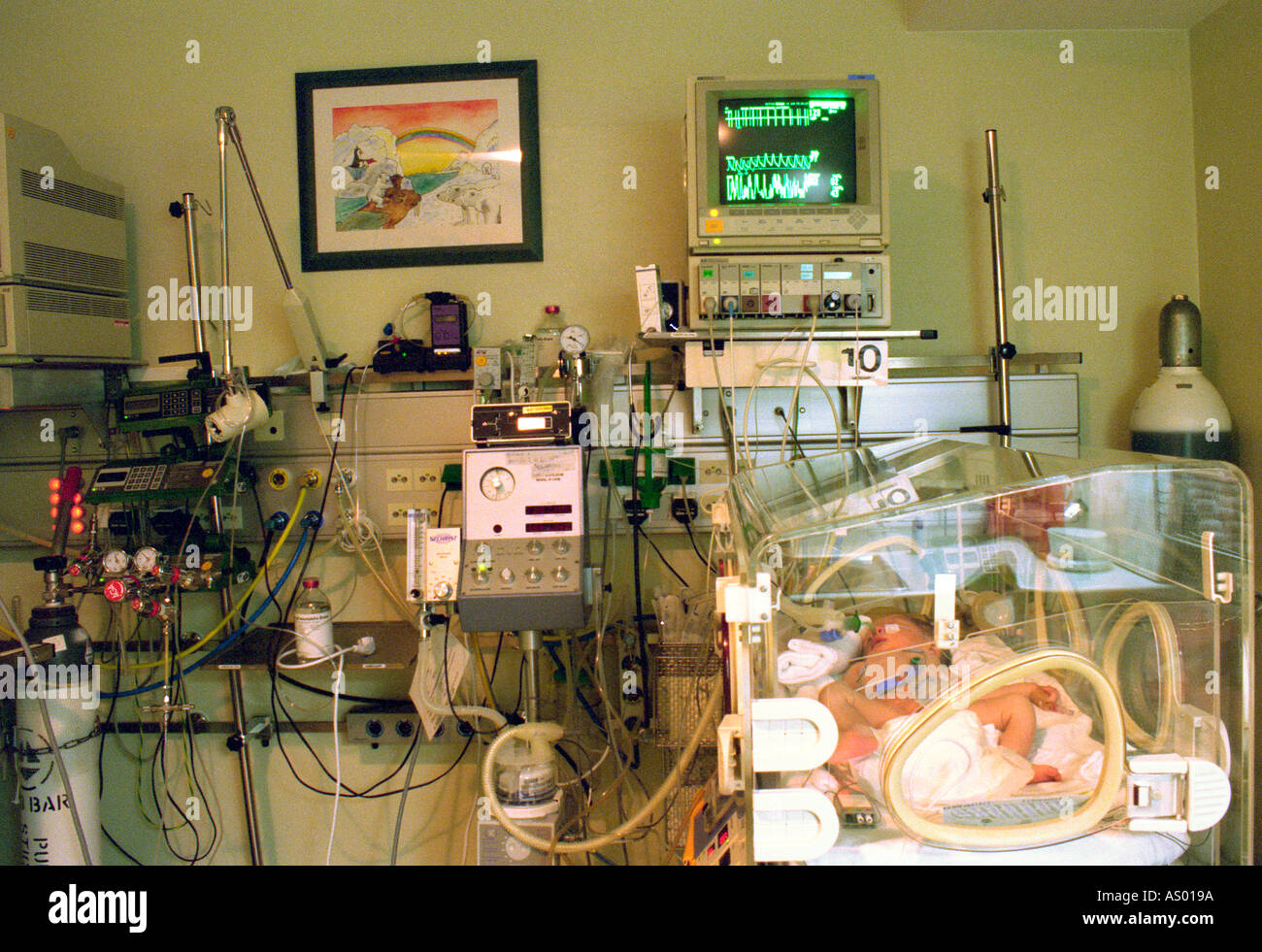eine Neugeborene in einer Intensivstation Stockfoto