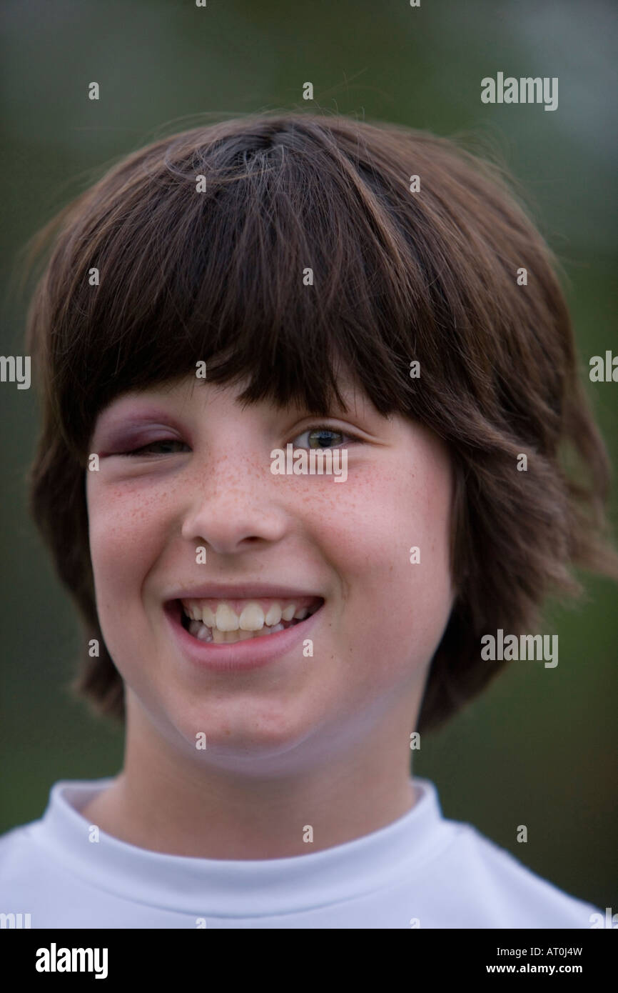 Junge boy10-11 verletzt spielen baseball Stockfoto