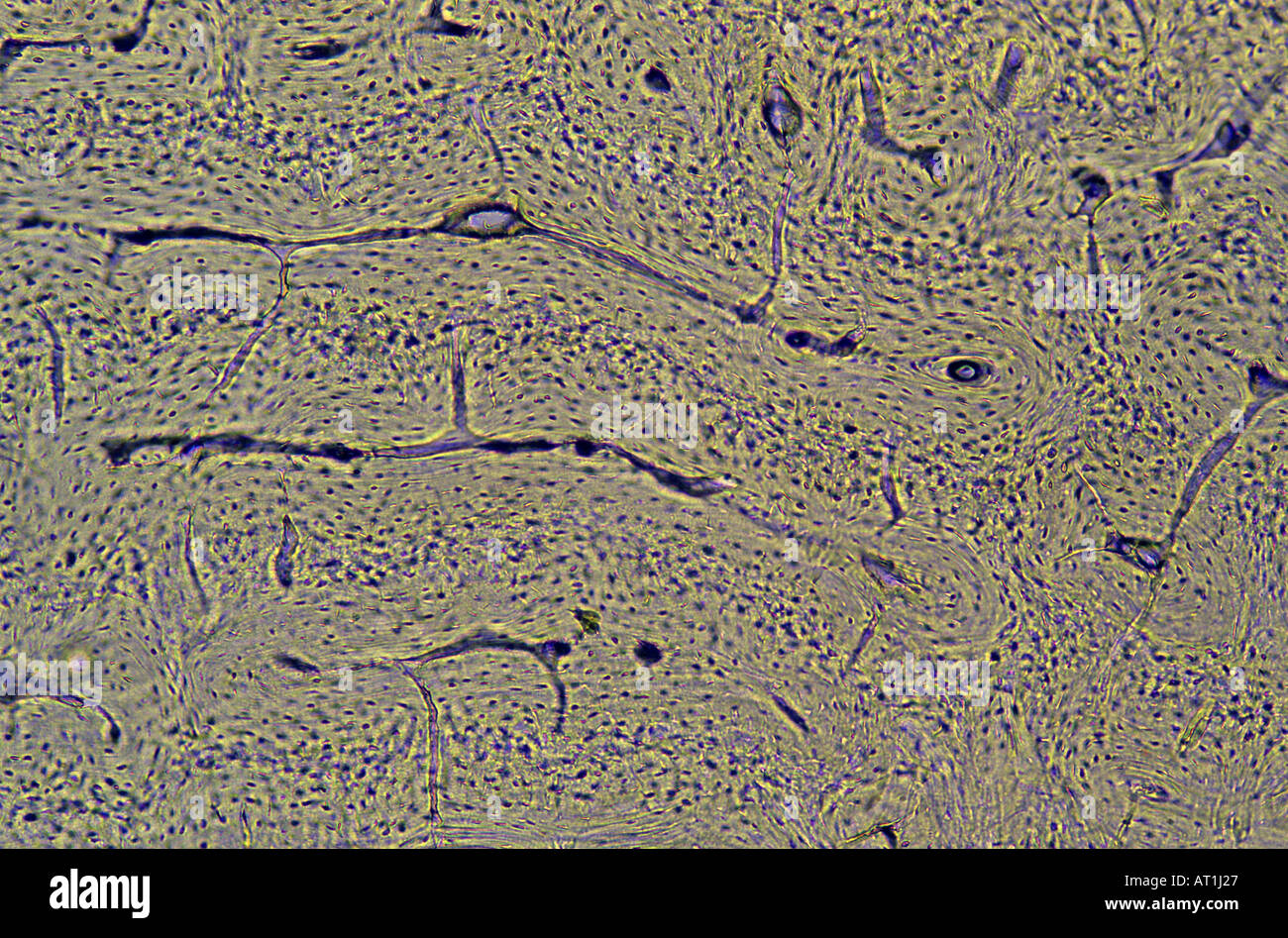 Knöchernen Gewebe 35 x Stockfoto