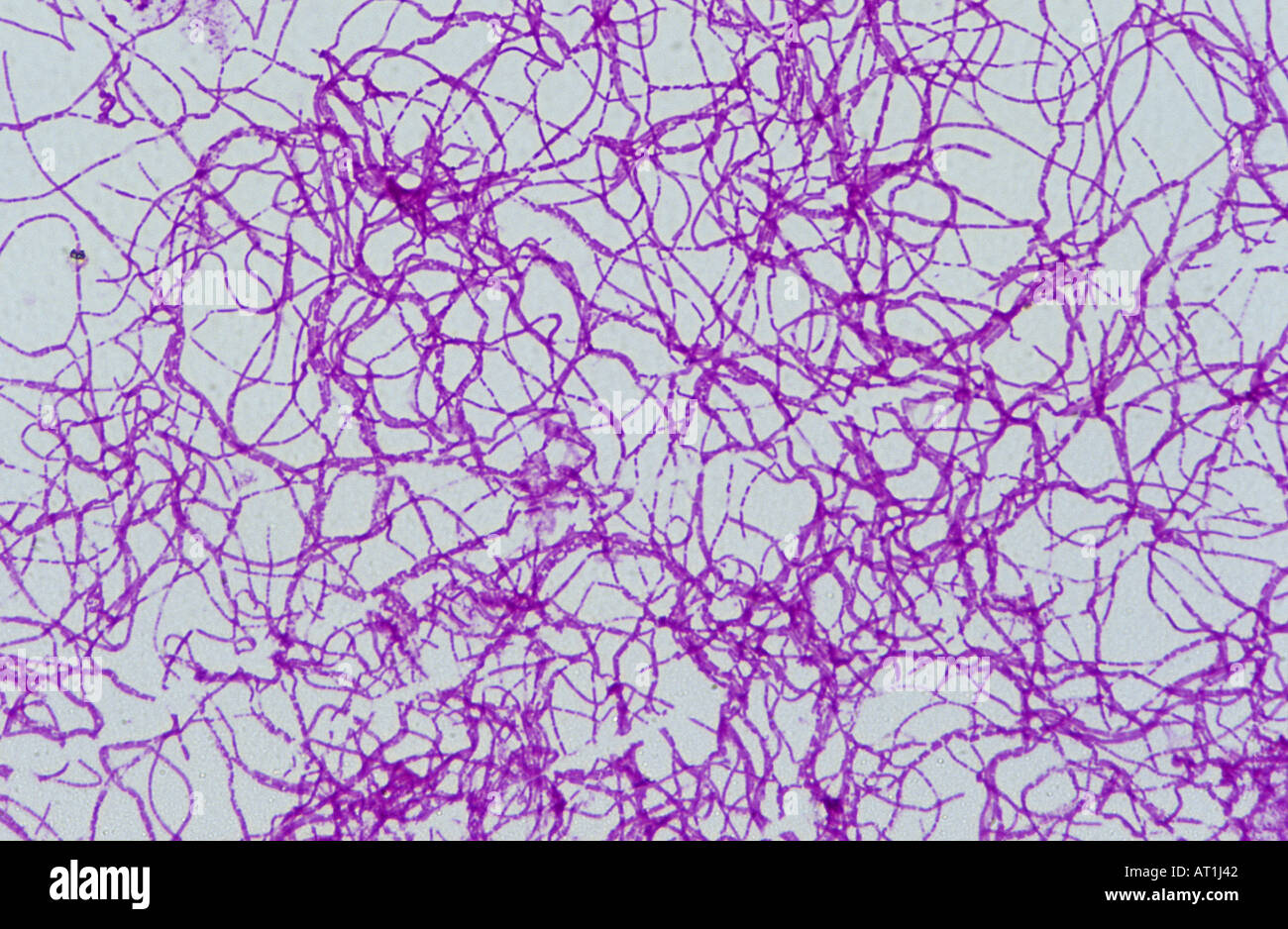 Bazillus Anthracis Bactery von Anthrax Gramm Stockfoto