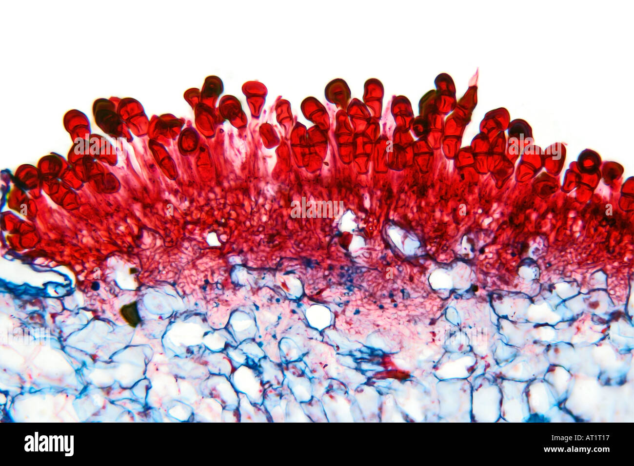 Mikrophotographie zeigen rostigen rote Pusteln der Zwergrost eine Pilzinfektion Stockfoto