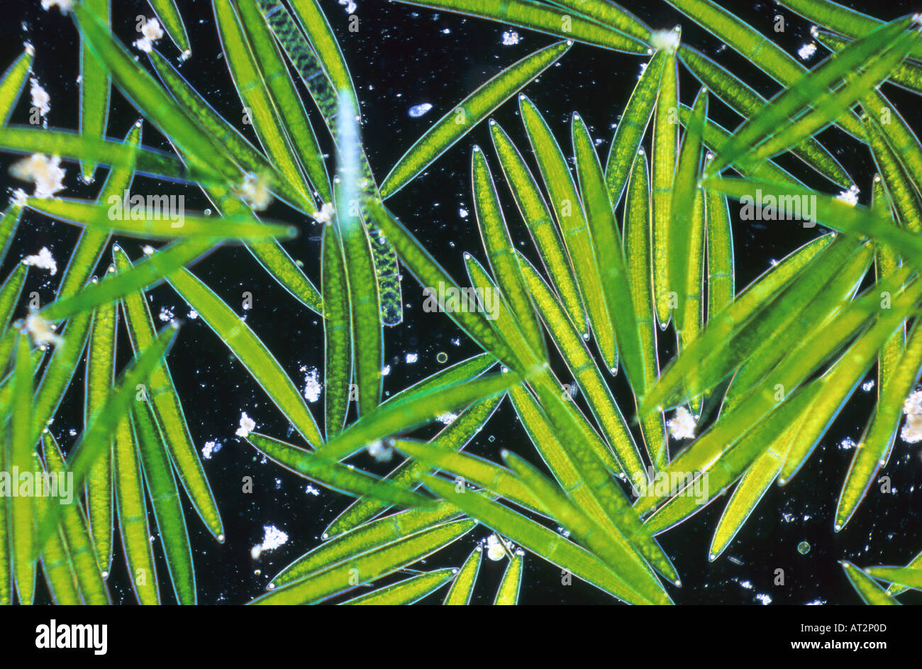 Closterium Chlorophyta Algen faseroptische micrsocopy Stockfoto