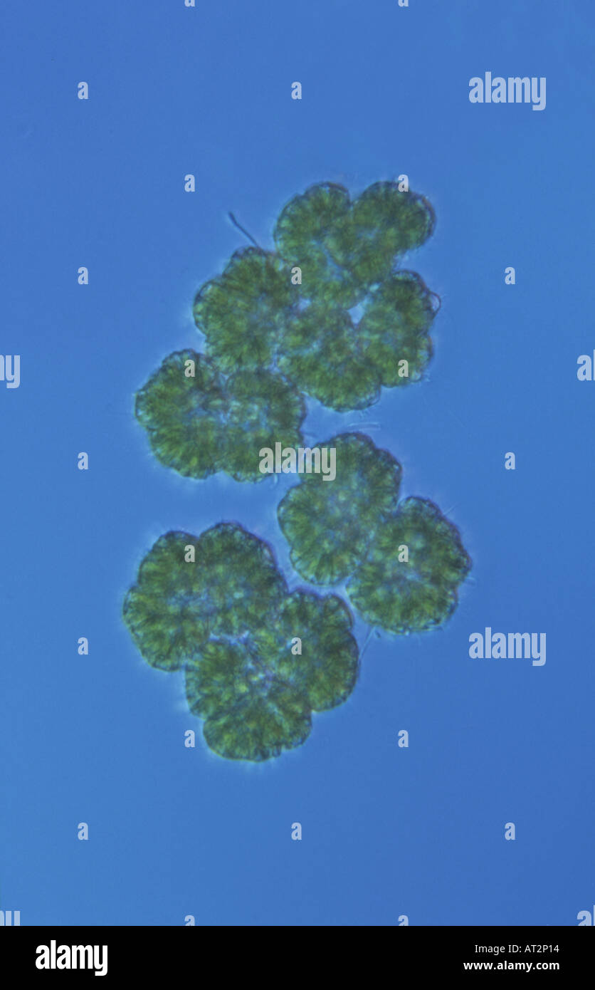 Algen Dictyosphaerium sp Differential Interferenz Kontrast Mikroskopie oder Normarsky Mikroskopie Stockfoto