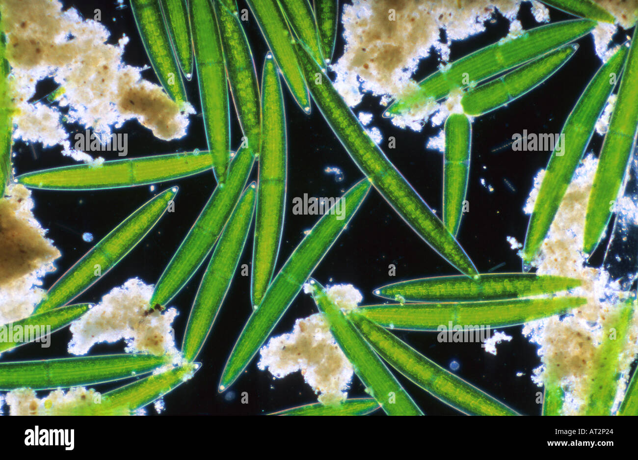 Closterium Chlorophyta Algen optische Mikroskopie Stockfoto