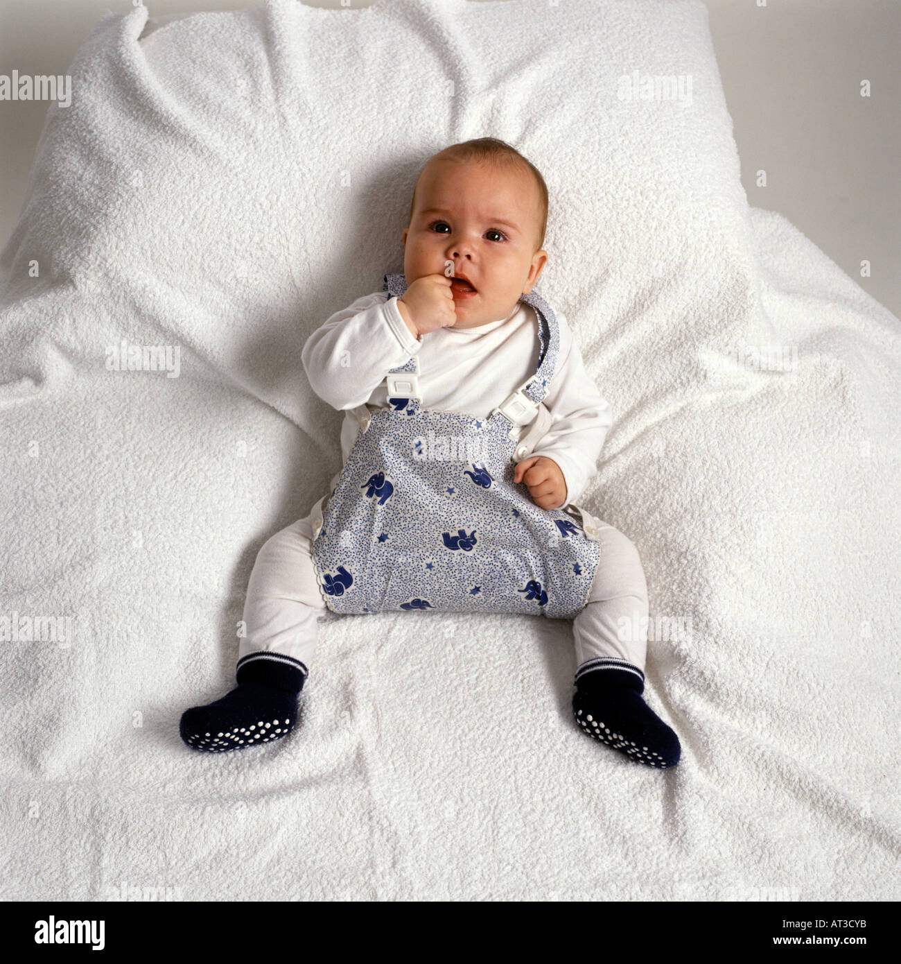 Baby mit einer Entwicklungsstörung Dysplasie-Hüfte Stockfoto