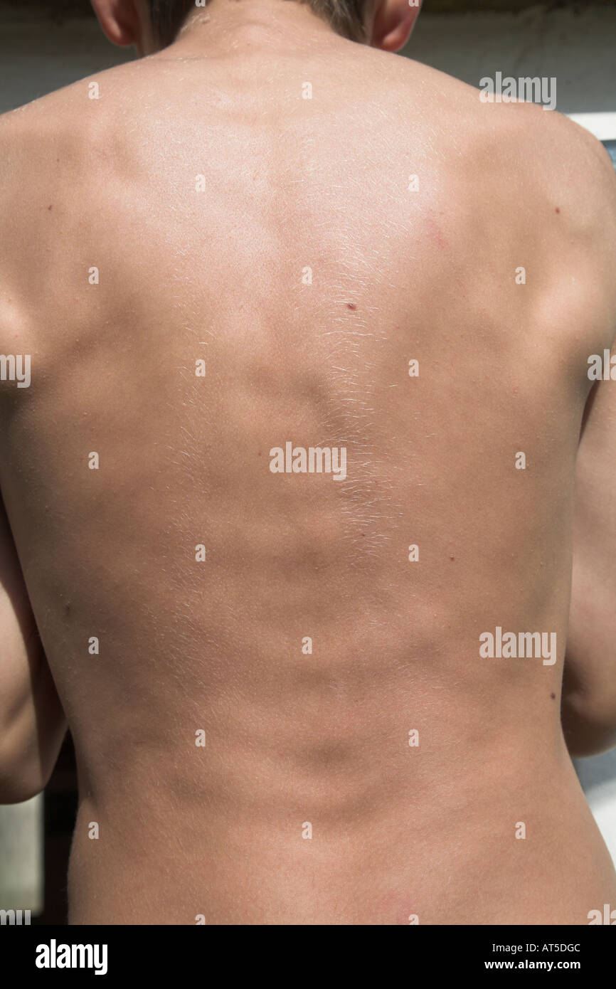 Blick auf verspannte Muskeln am Rücken eines jungen Mannes Stockfoto