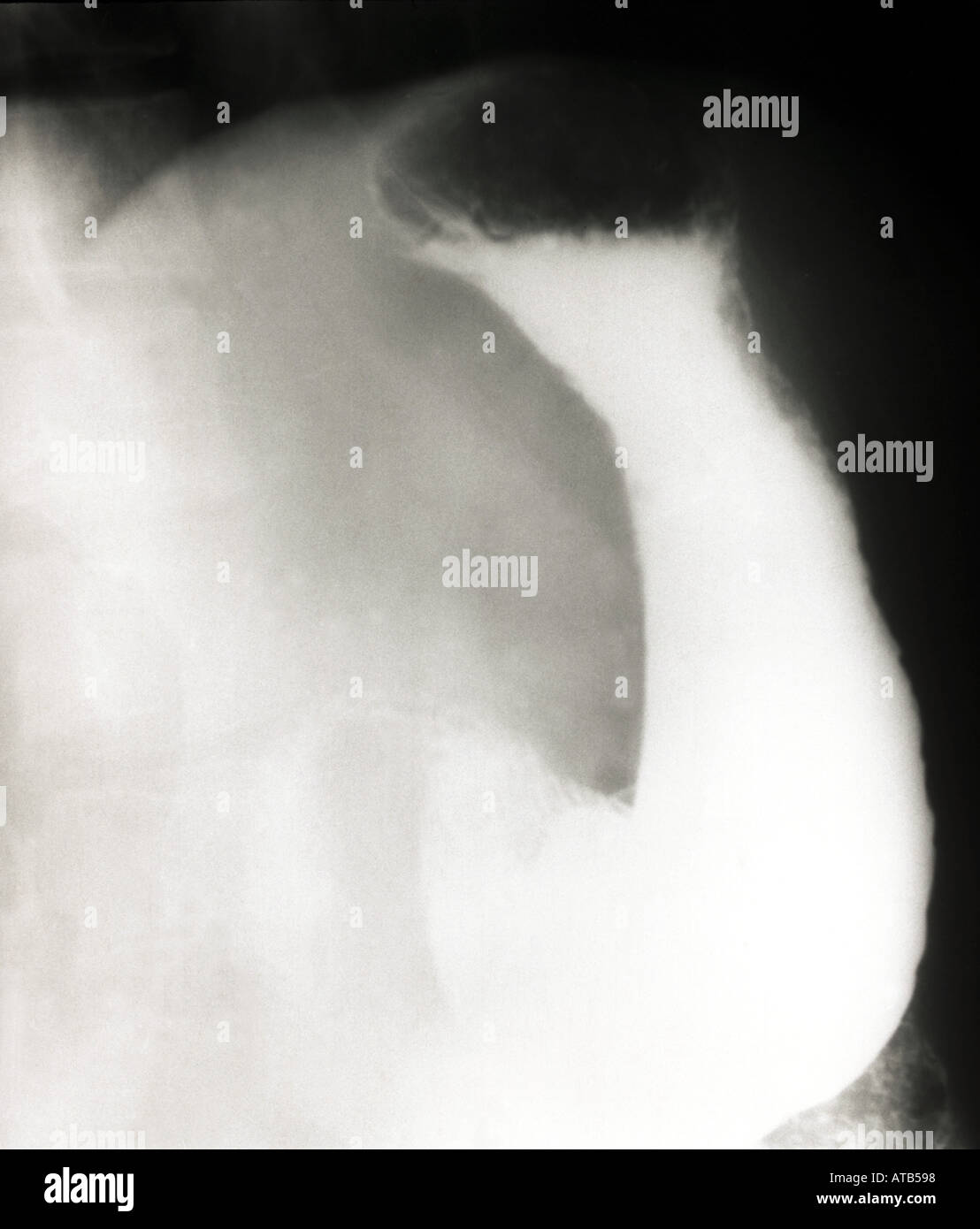 Normale Barium-Schwalbe Stockfoto