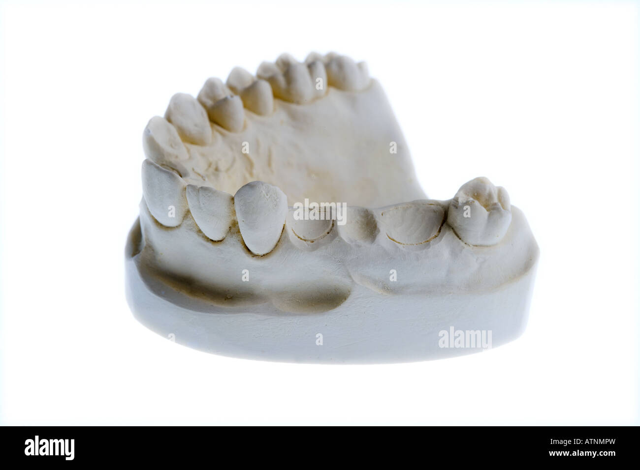 Dental Zahn-Implantate in einer Form von einem Personen-Mund auf weißem Hintergrund Stockfoto
