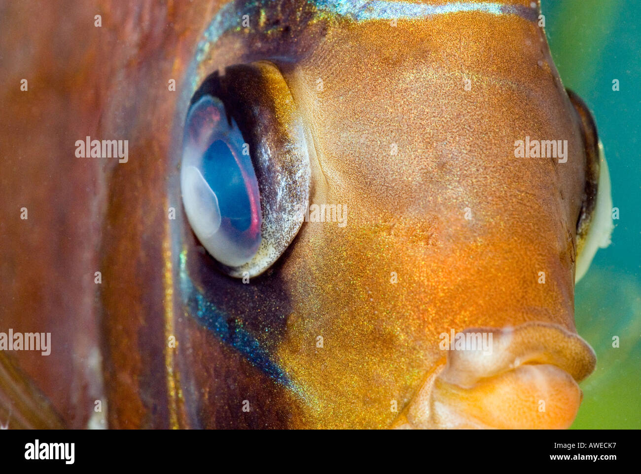 Trübung Dumpfheit Krankheit Krankheit Krankheit Eyedisease