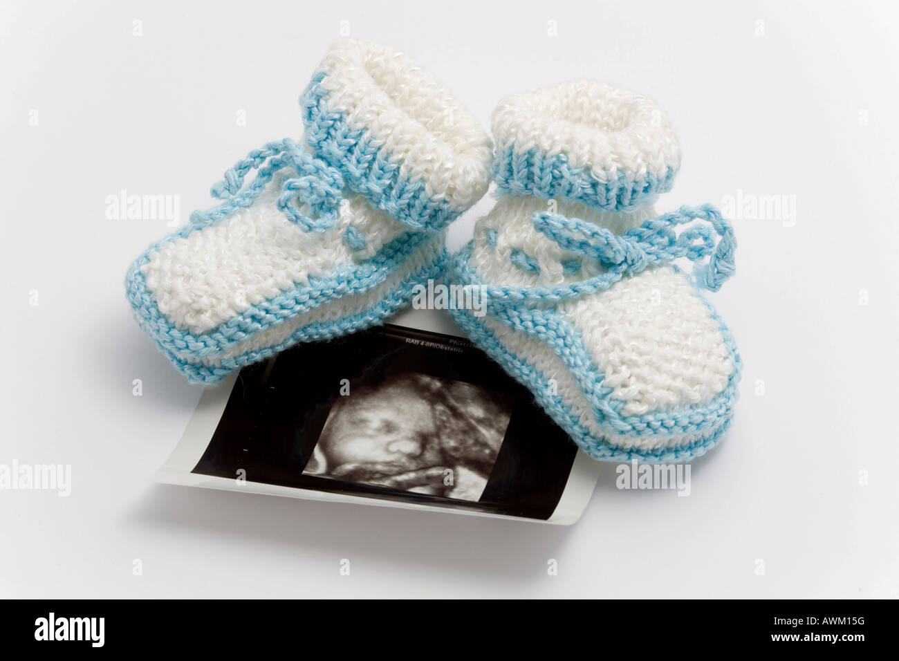Ultraschall mit Baby-Schuhe Stockfoto