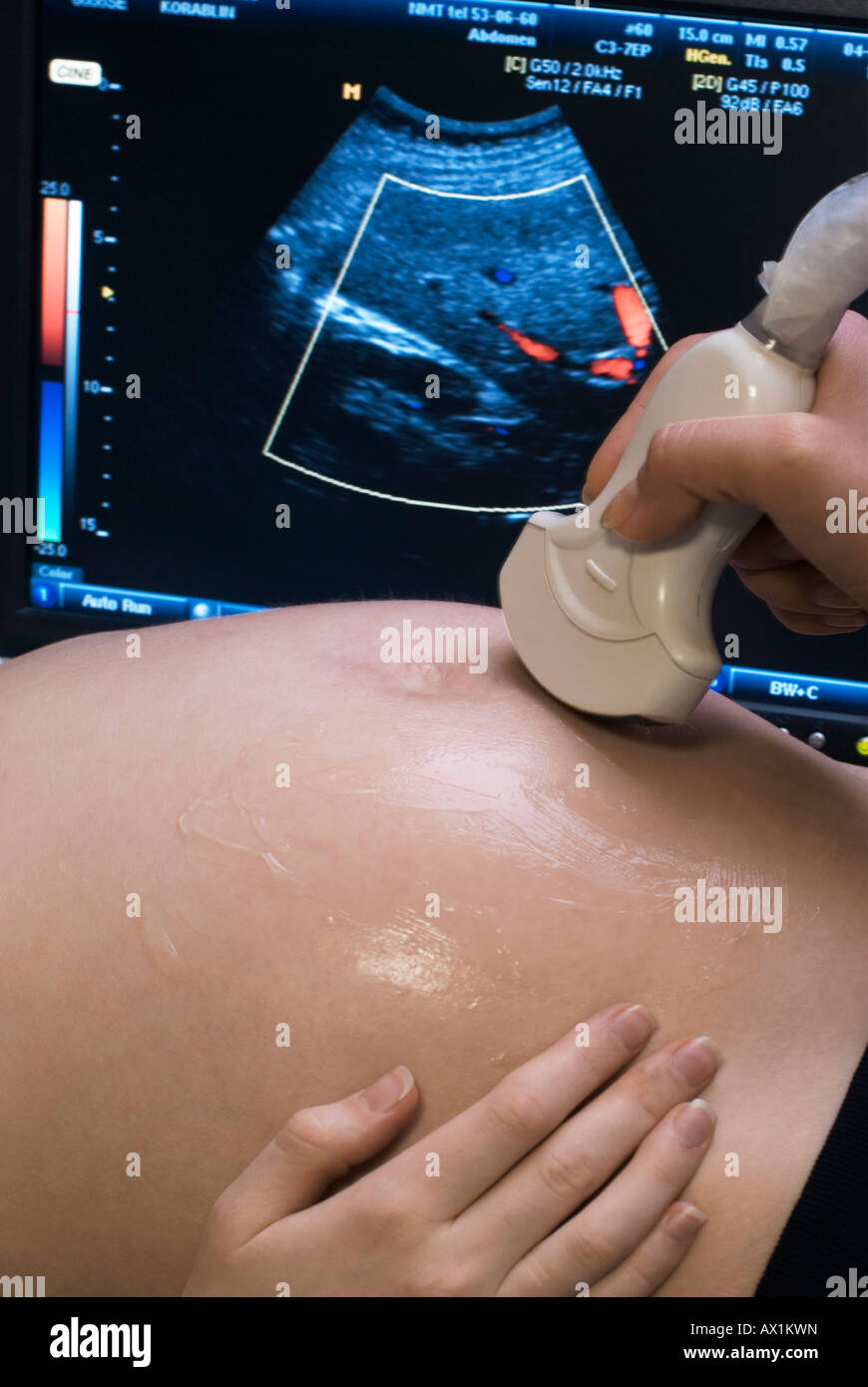 Eine Frau, die eine Ultraschalluntersuchung Stockfoto