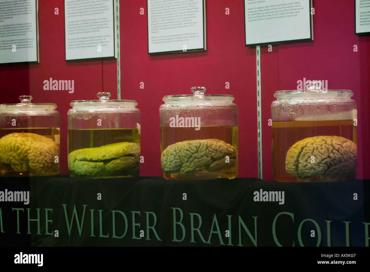 Von der Wilder Brain Collection an der Cornell University, Ithaca, New York, Tompkins County. Stockfoto