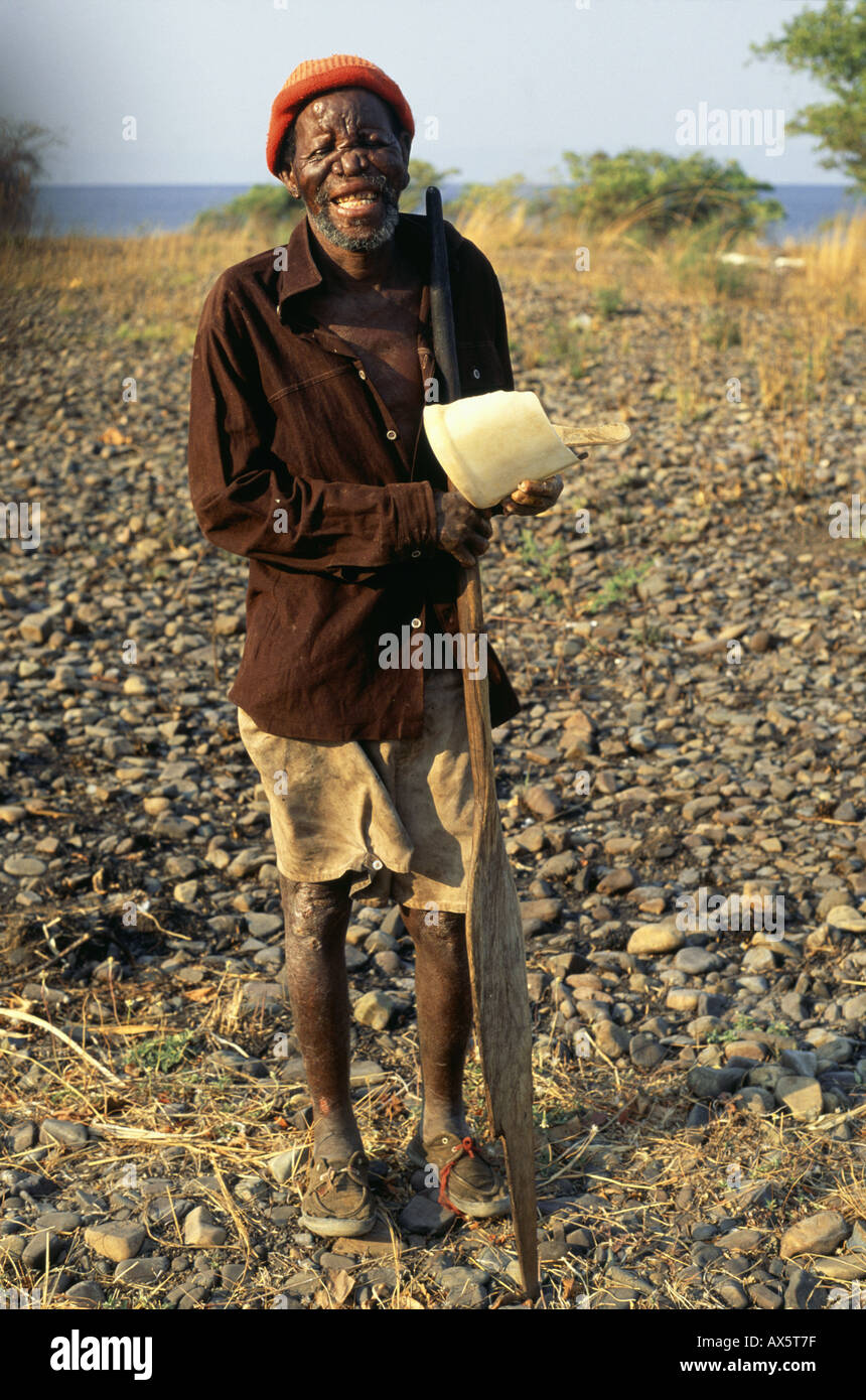 Genannte, Tansania. Älteren afrikanischen Mann mit Gesicht und Händen durch Lepra (Hansens Krankheit) verformt. Stockfoto
