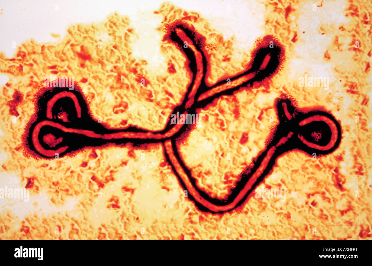 Ebola-virus Stockfoto