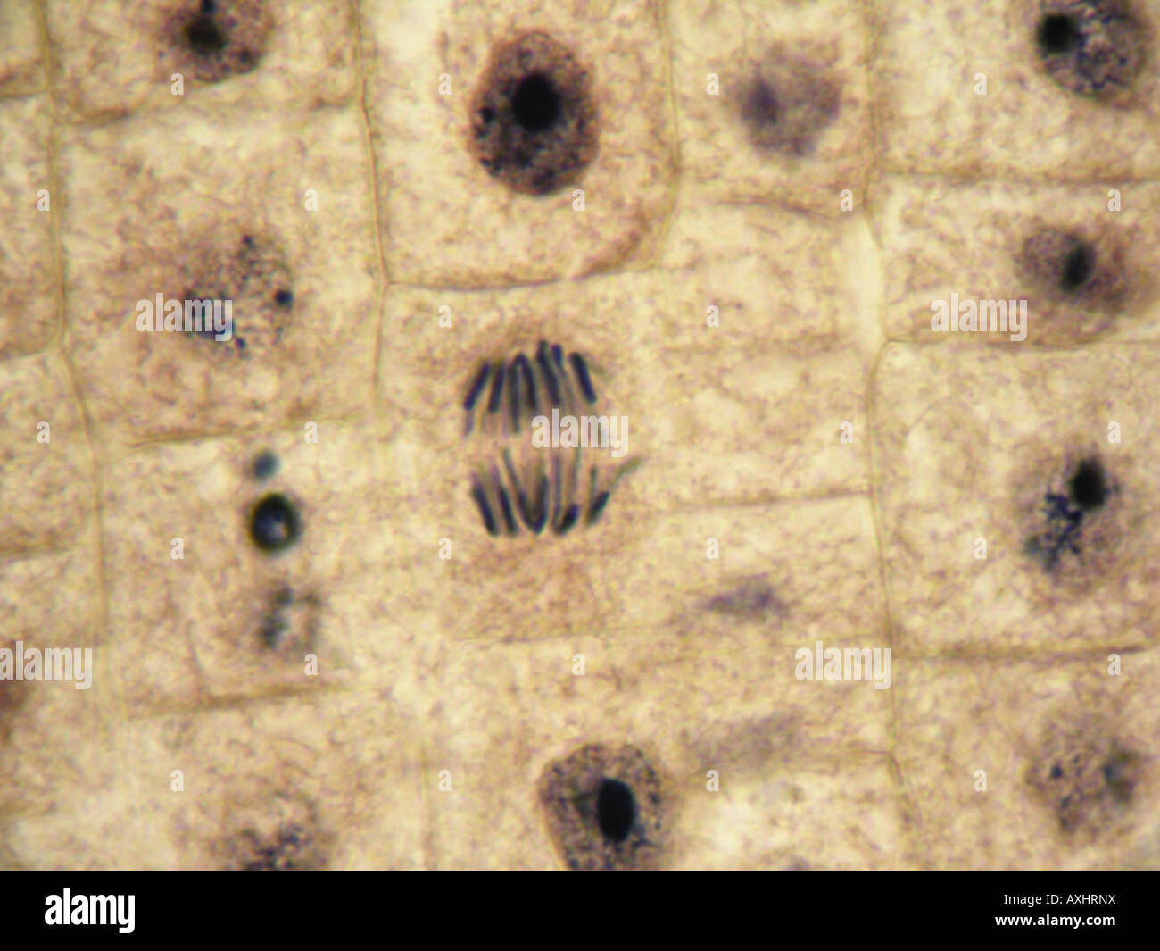 Mitose (Anaphase) in Zwiebel-Gewebe bei 1000 X unter optischen Mikroskop. Immersion Öl Objetive 100 x Stockfoto