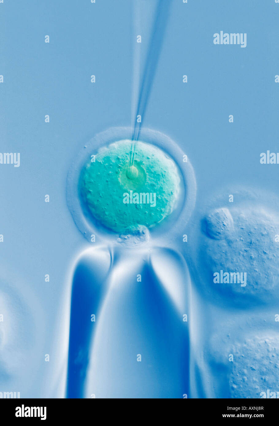 Mikroinjektion von menschlichen embryonalen Stammzellen ES Zellen in Eizelle Eizelle Klonen Stockfoto