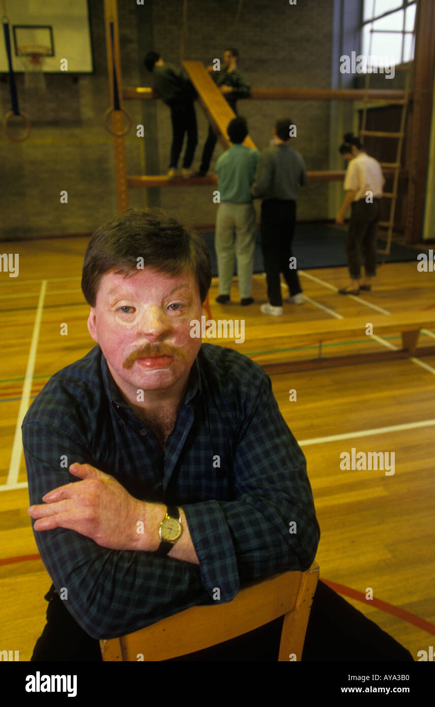 Simon Weston Portrait Falklands Kriegsopfer Held. 1988 Aufbau der Operation Weston Spirit mit jungem Nachteil 1980er Jahre Liverpool UK HOMER SYKES Stockfoto