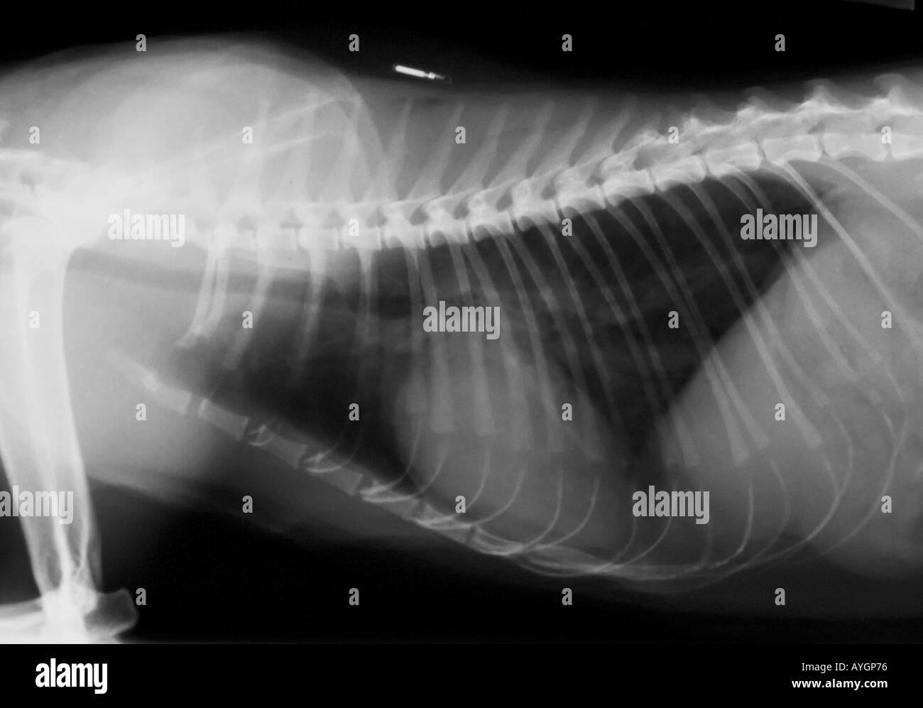 XRAY Cays Brust mit Herz-Kreislauferkrankungen Stockfoto