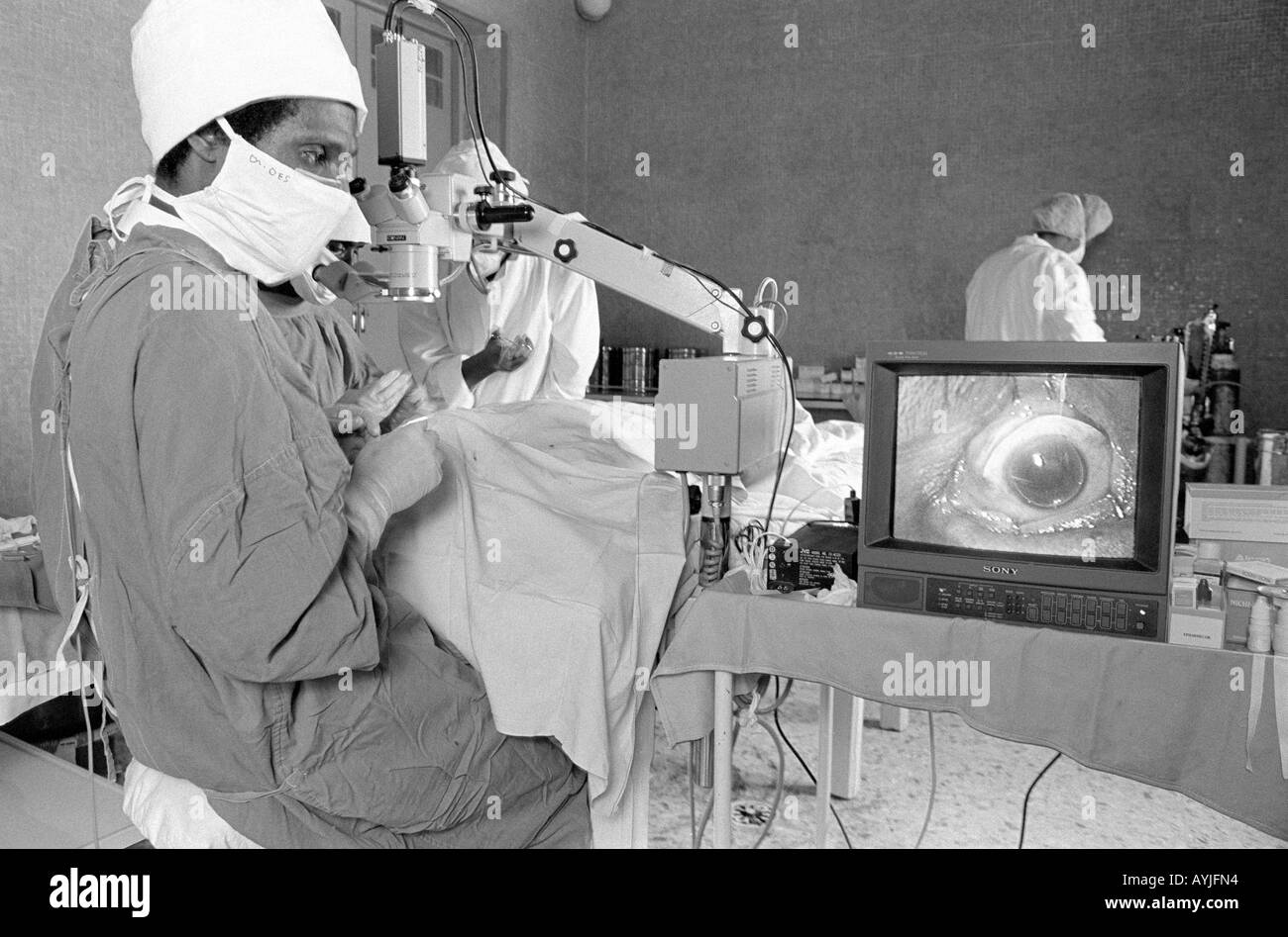 B/W eines Augenchirurgen, der eine Kataraktoperation mit Vergrößerung auf einem Monitor im Asmara-Krankenhaus durchführt. Asmara, Eritrea Stockfoto