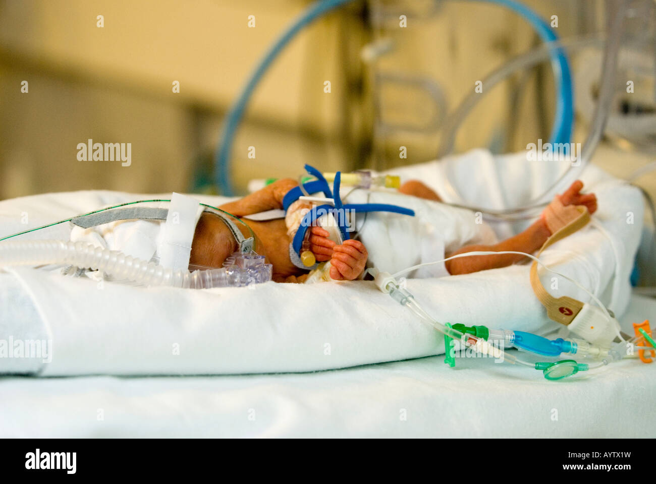 Frühgeborenes im Inkubator Stockfoto