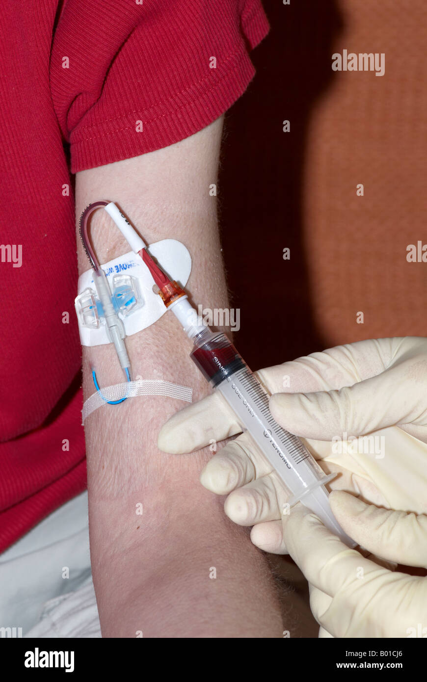 Blutentnahme aus einer Picc Linie peripher eingefügte zentrale Katheter mit  einer Spritze und OP-Handschuhe tragen Stockfotografie - Alamy
